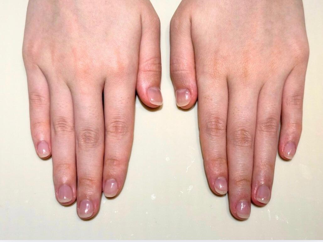 福岡市博多リプロネイル式深爪矯正専門サロンルソア